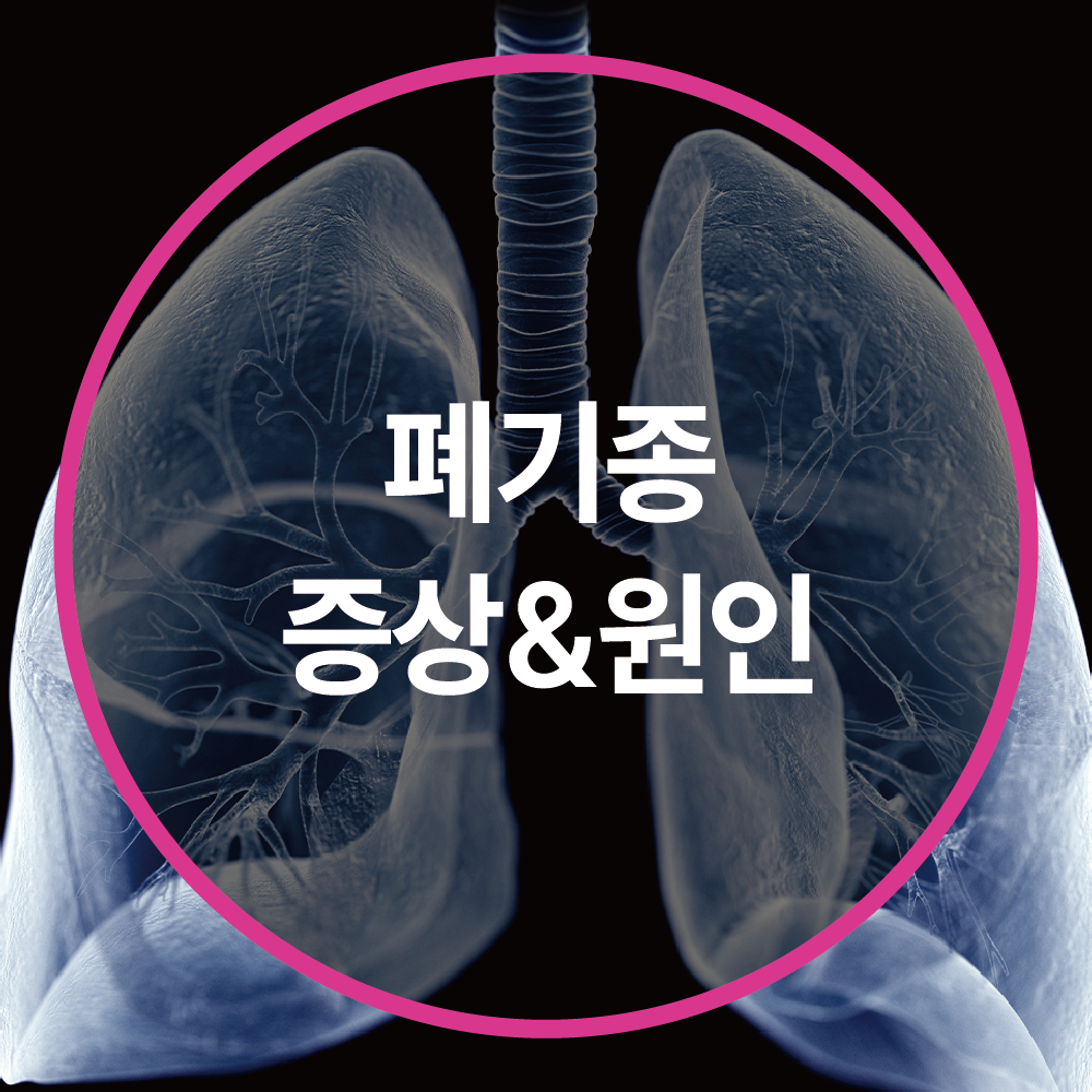폐기종 증상 및 원인 총정리 – 조기 발견이 중요합니다!