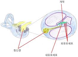 이명증 치료 방법과 효과