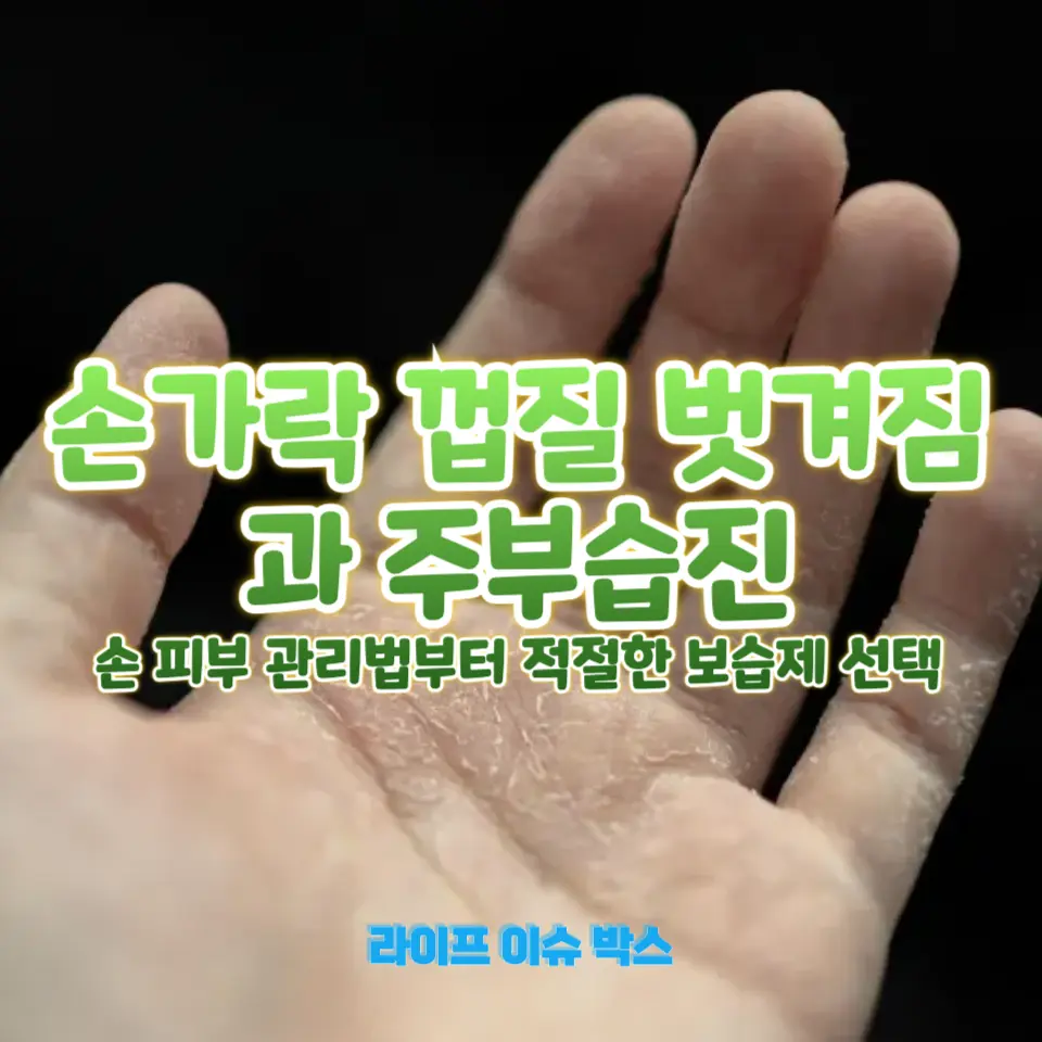 손가락 껍질 벗겨짐 해결법