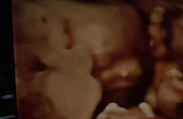 빈지노 미초바 임신 소식