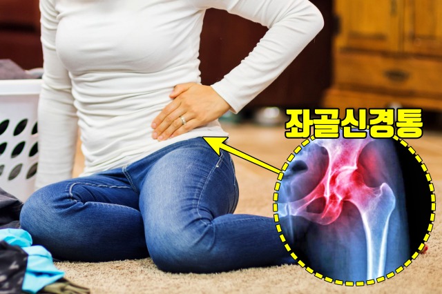 골반통증 좌골신경통 자궁암 증상 원인, 자궁경부암, 자궁경부암초기증상, 건강 팁줌 매일꿀정보