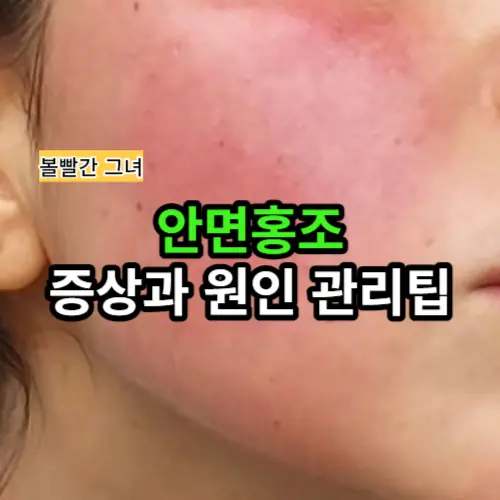 볼빨간 안면홍조, 얼굴 붉어질 때 어떻게 대처할까?