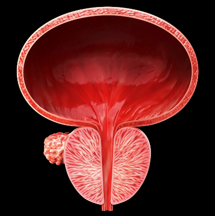 전립선 비대증의 원인