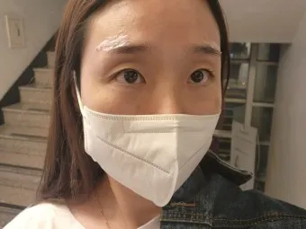 눈썹 문신 제거 방법 꿀팁_18