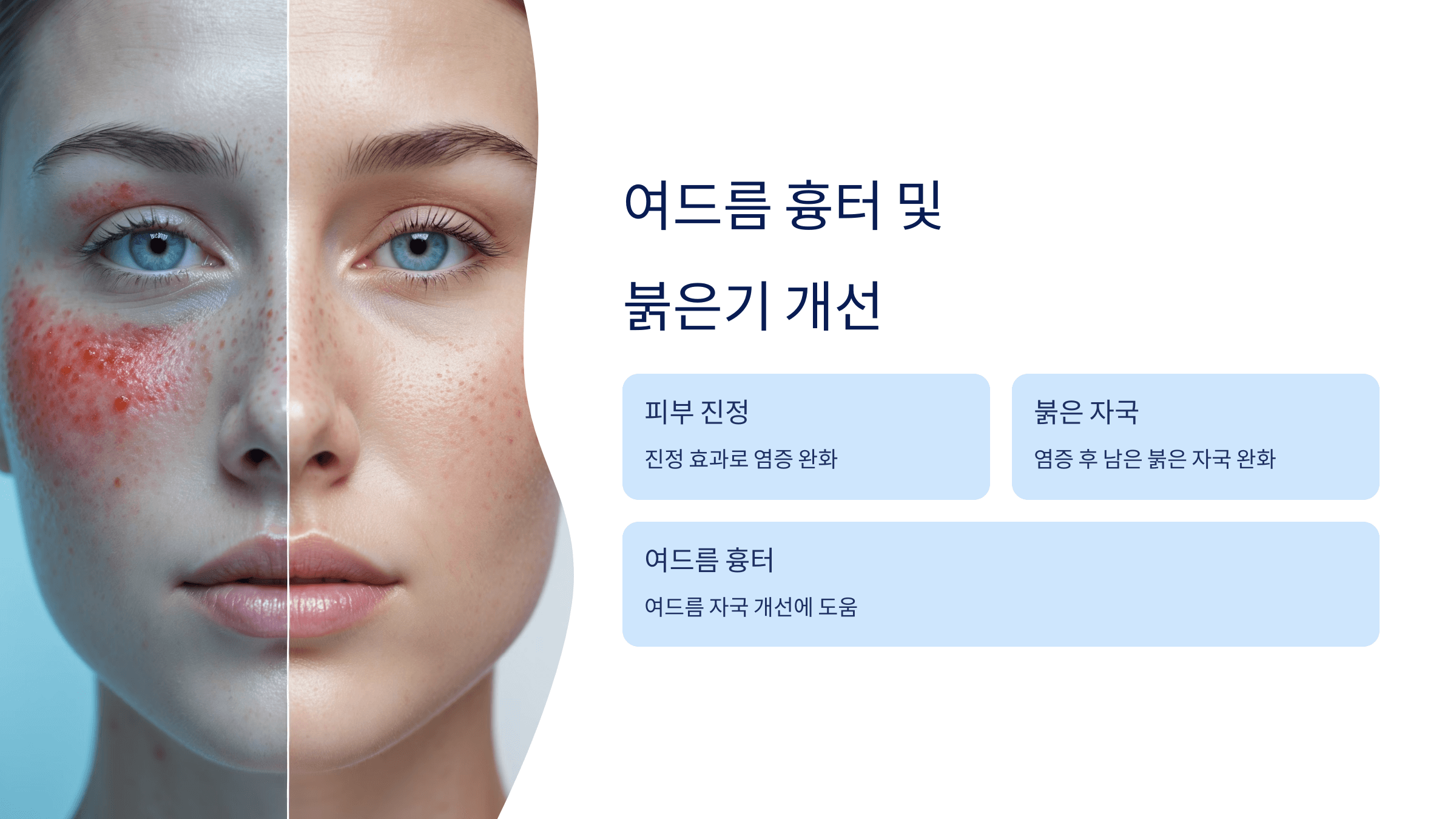 히알루론산과 관련된 사진입니다.