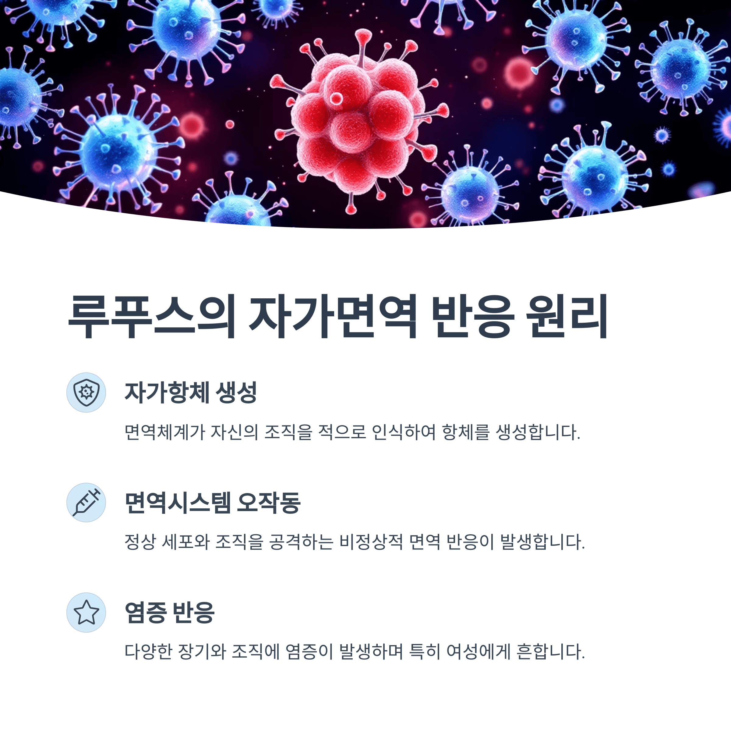 루푸스의 자가면역 반응 원리
