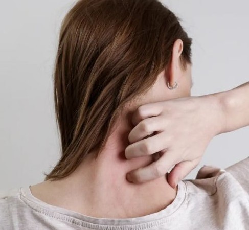 비판텐 연고 효능