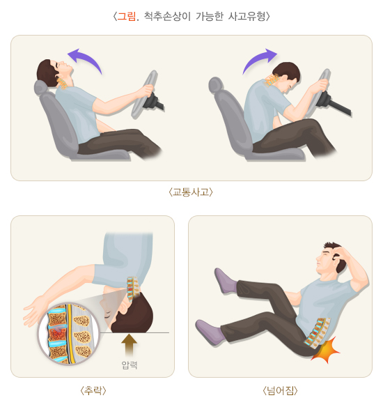 척추골절