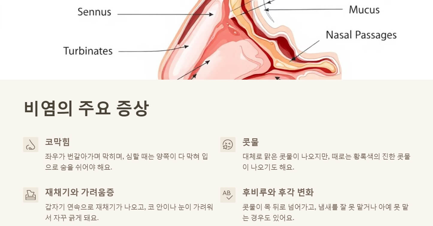 비염 증상 치료방법