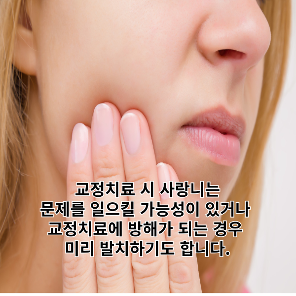 교정치료-사랑니-발치-썸네일