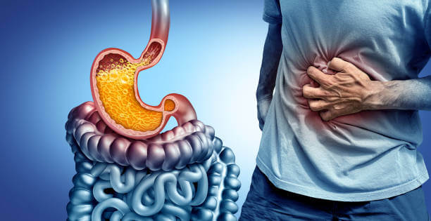 역류성식도염 치료, 평촌 환자들이 많이 찾는 병원은?