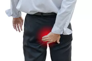 치질 증상