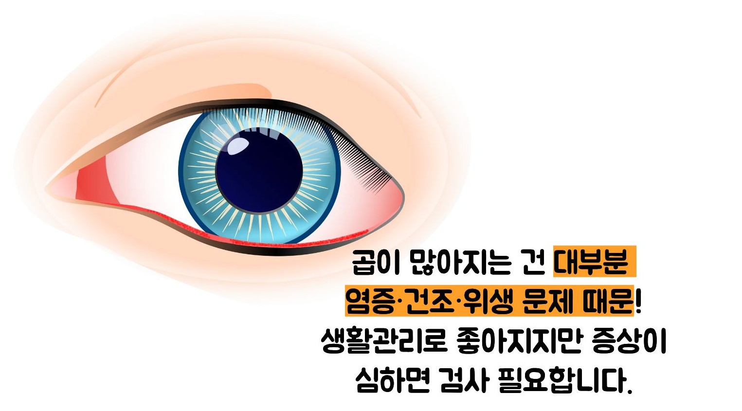 눈꼽이 잘 끼는 이유