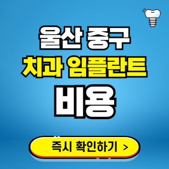 울산 중구 임플란트 가격 비용 조회하기 ❘ 내 근처 저렴한 치과 찾기