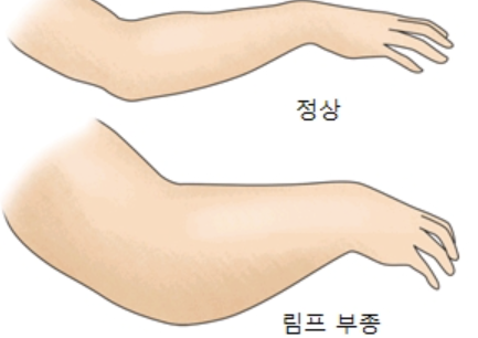 임파선염 증상 33