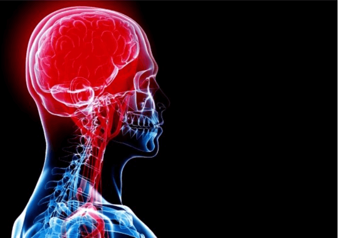 뇌경색에-좋은음식