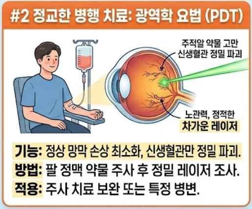 황반변성 치료법