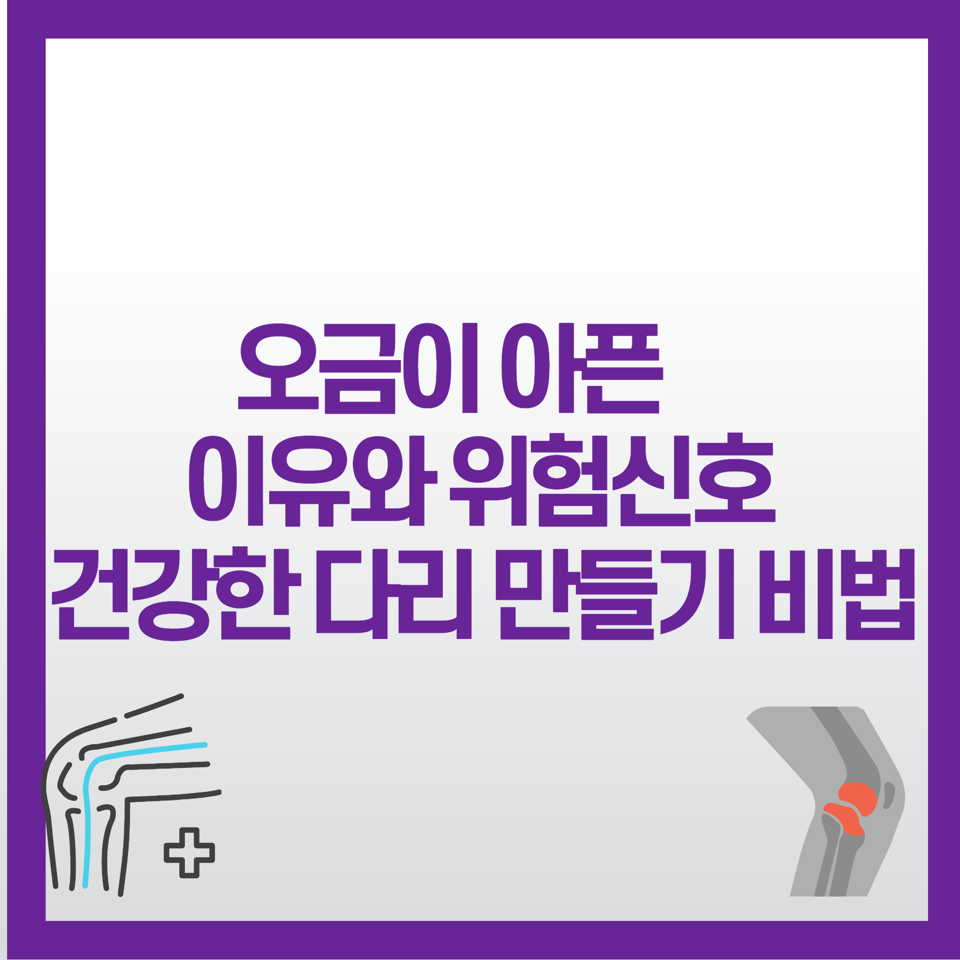 오금이 아픈 이유