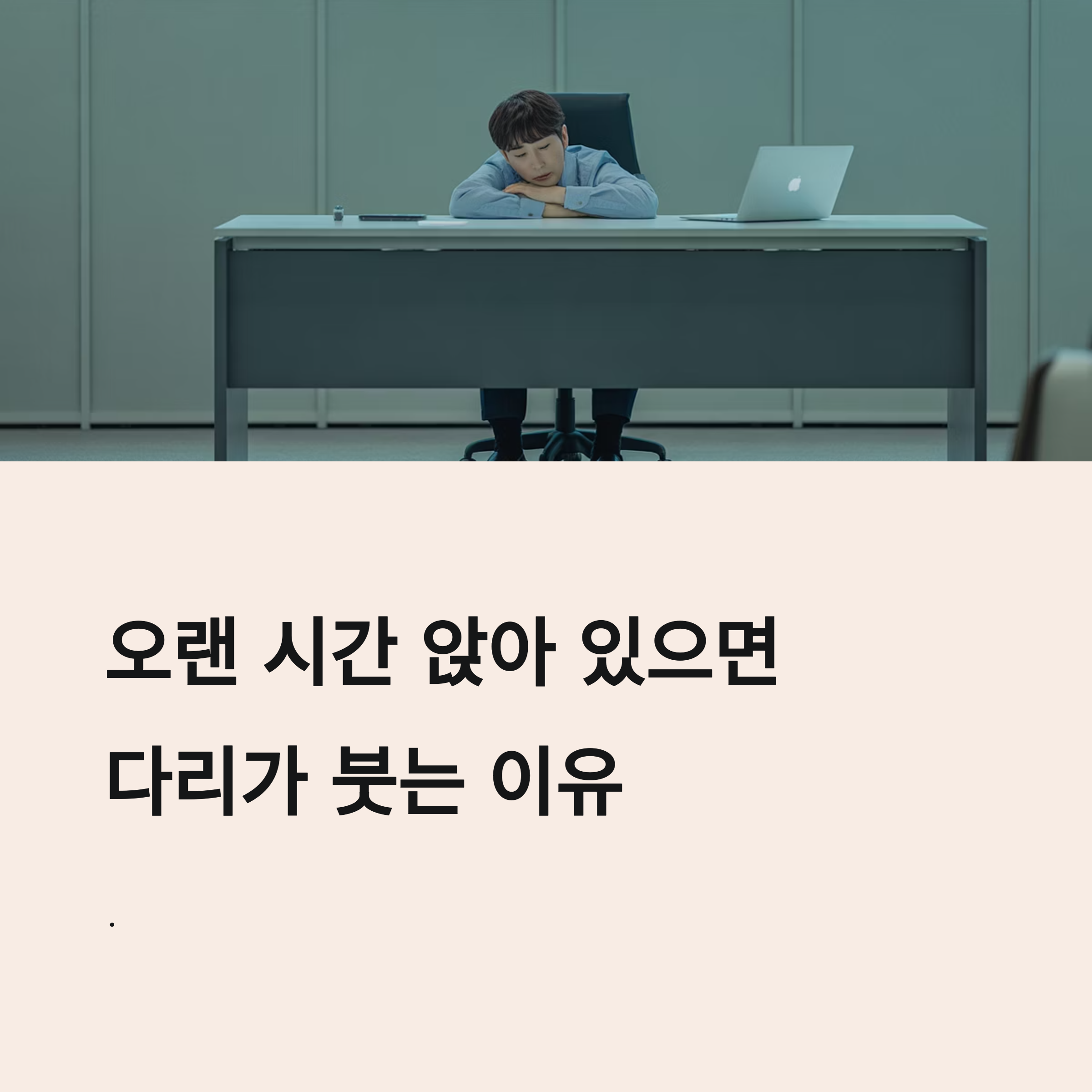 직장인을 위한 다리 붓기 해결법