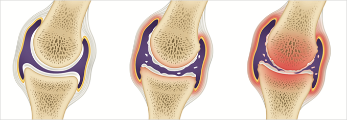 뼈엔 mbp 가격 후기 (3주 섭취)