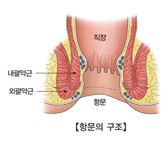 항문 주름과 잔변이 남을 수 있는 상황을 설명하는 이미지