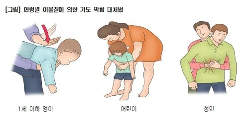 연령별 하임리히법