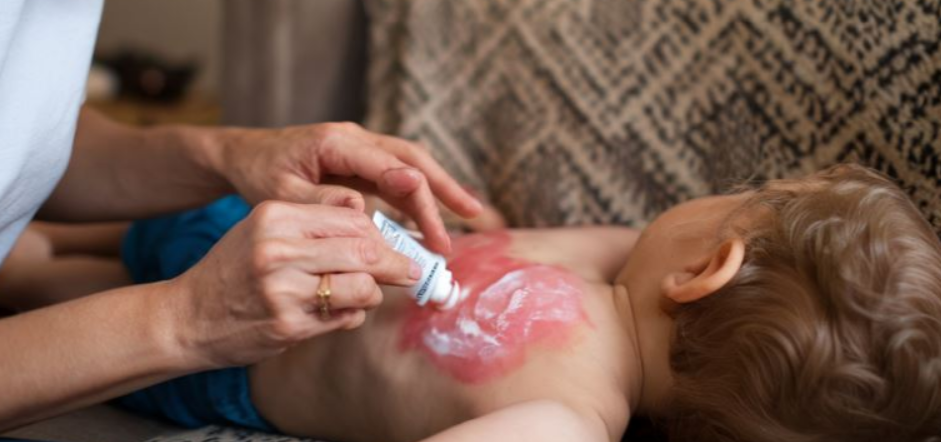 우리 아이의 아토피! 방법이 있는데 왜 안하시나요?