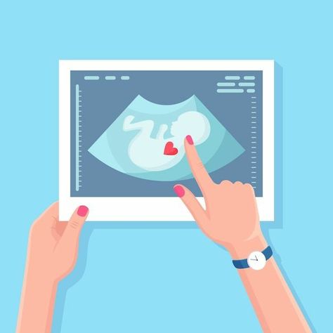 태반의 이해에 대한 사진