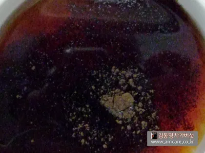 검은 변 원인 위장 출혈 가능성 있는 소화기 질환 정리_7