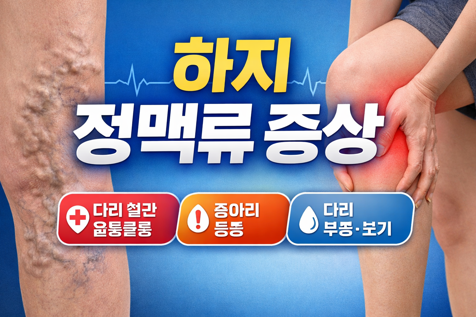 하지 정맥류 증상