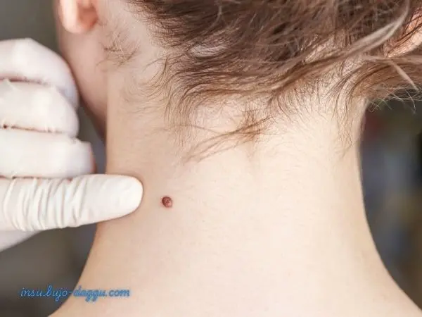 건강검진 &lsquo;이상 소견&rsquo; 있을 때 가입 가능한 보험 5단계 준비 가이드