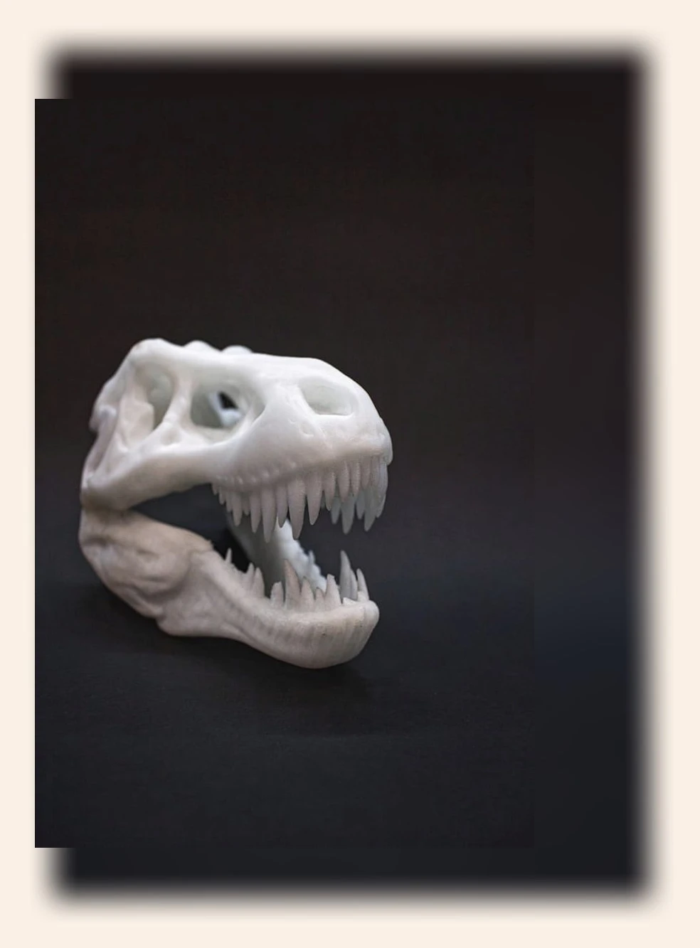 30대 전악 임플란트_1_subsection