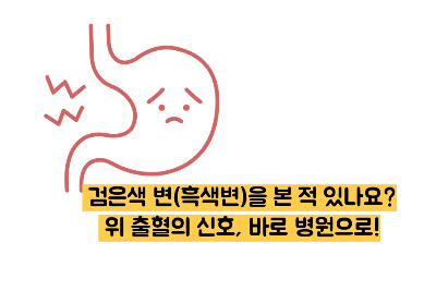 위궤양 증상