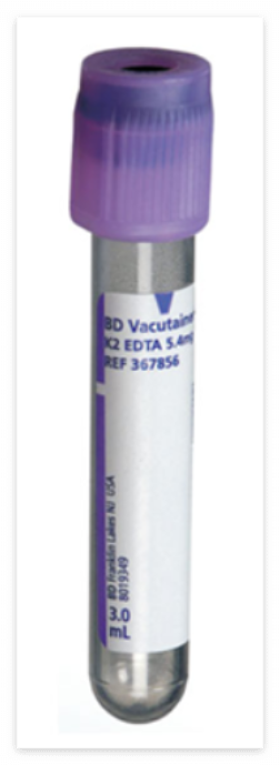 혈액 검사 보라색 튜브