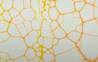 미오이노시톨 과 활성형 엽산