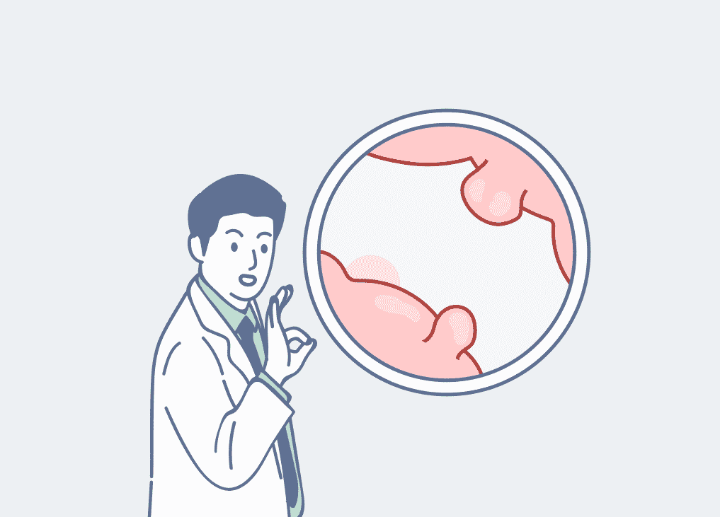 🔍 건강검진 결과 이상소견 추가검사 비용 절약하는 실전 가이드