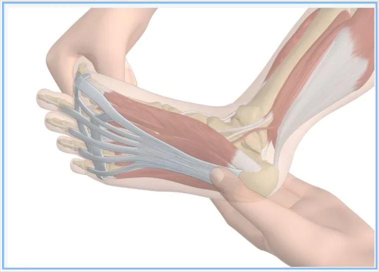 족저근막염 발생 부위 옆면