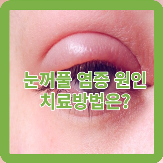 눈꺼풀 염증 원인 및 치료방법