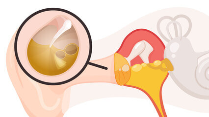 소아 유아 중이염 증상 원인 치료