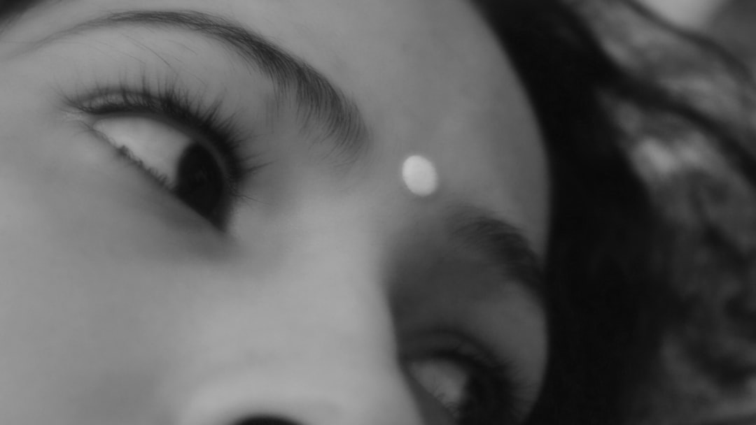 Double eyelid