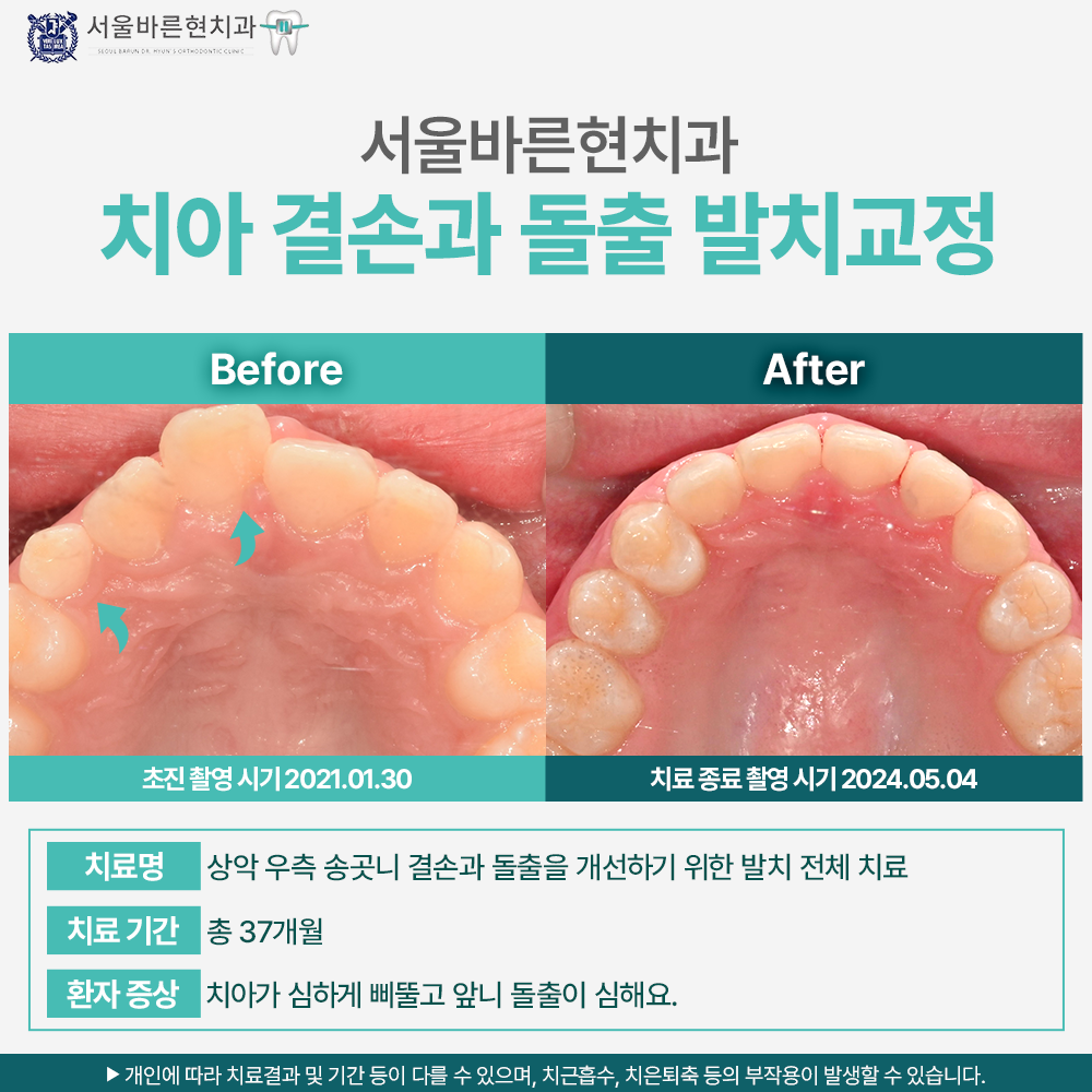 부산교정치과