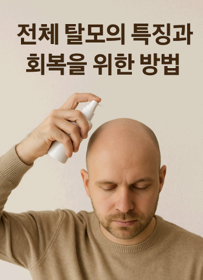 전체 탈모의 특징과 회복을 위한 방법