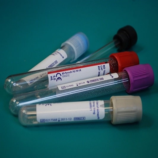 갑상선 기능 저하증 증상