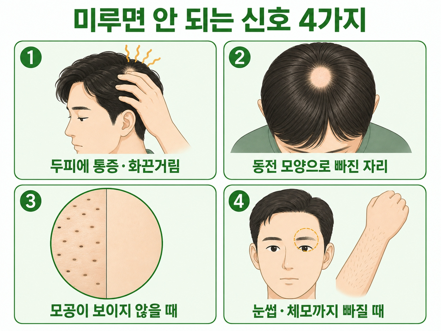탈모 병원 가야 하는 시기 미루면 안 되는 신호 4가지