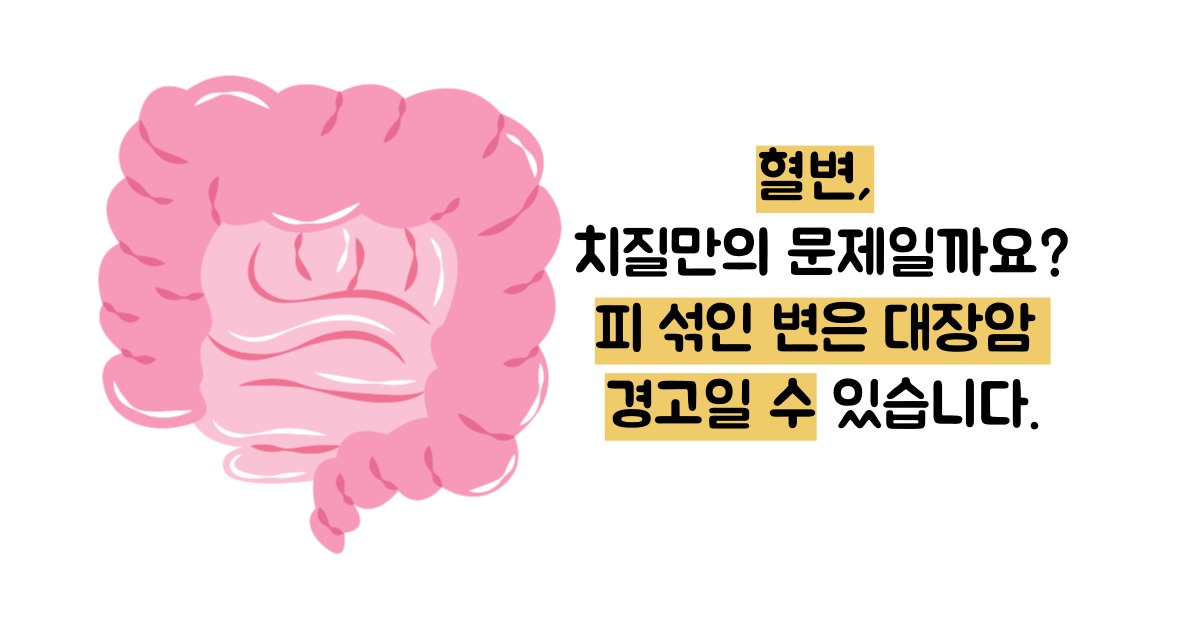 대장암 초기증상