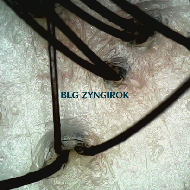 탈모 극복 프로젝트 - 뒷머리 두피 모습이다.