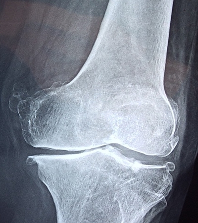 양파 효능 사진12