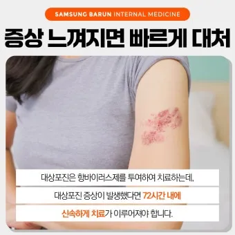 대상포진 치료방법에 대한 총정리 건강 질병관리_13