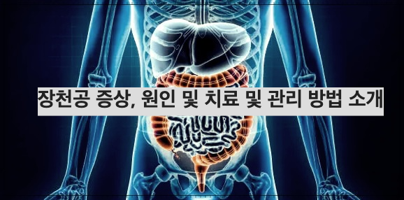 장천공 증상&#44; 원인 및 치료 및 관리 방법 소개