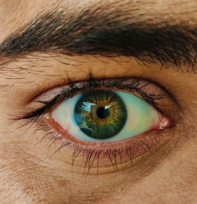 녹내장 치료법 진단 기준 합병증